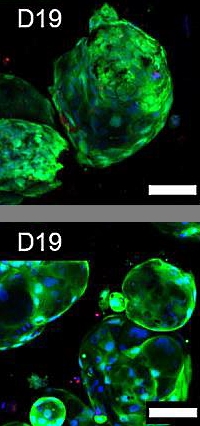 Decellularized Extracellular Matrix Composite Hydrogel Bioinks for the Development of 3D Bioprinted Head and Neck in Vitro Tumor Models